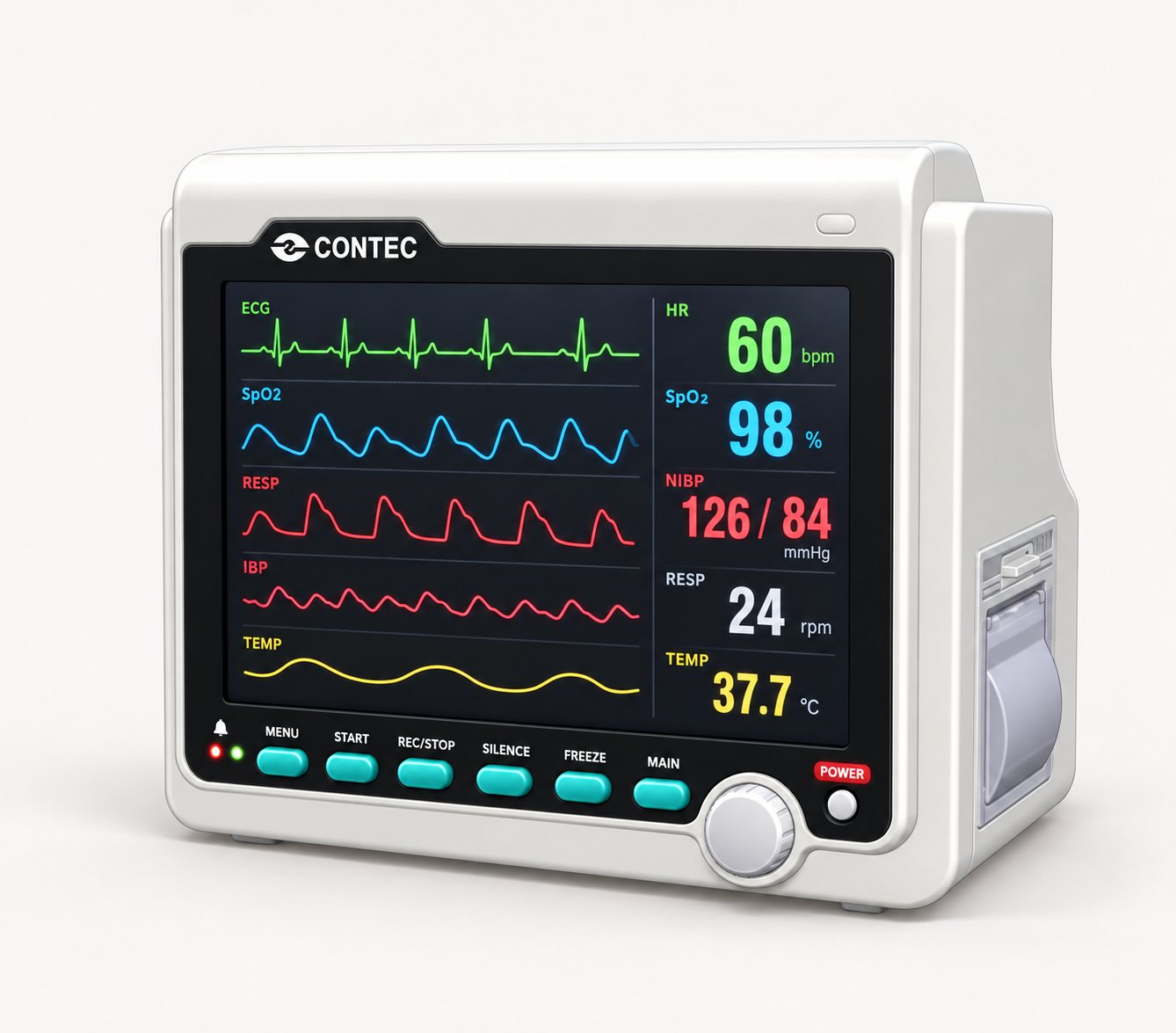 EKG MONITOR